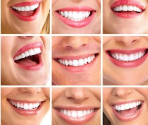 Different Smiles